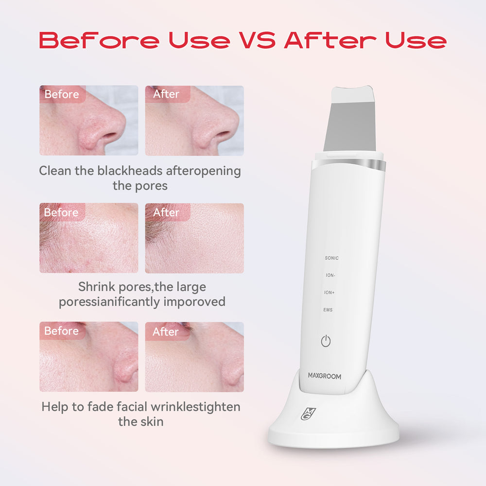 MAXGROOM M-169 ultrasonic cavitation peeling device with LED light therapy - white