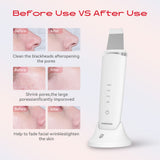 MAXGROOM M-169 ultrasonic cavitation peeling device with LED light therapy - white